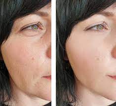 Collagen Mask Vellura