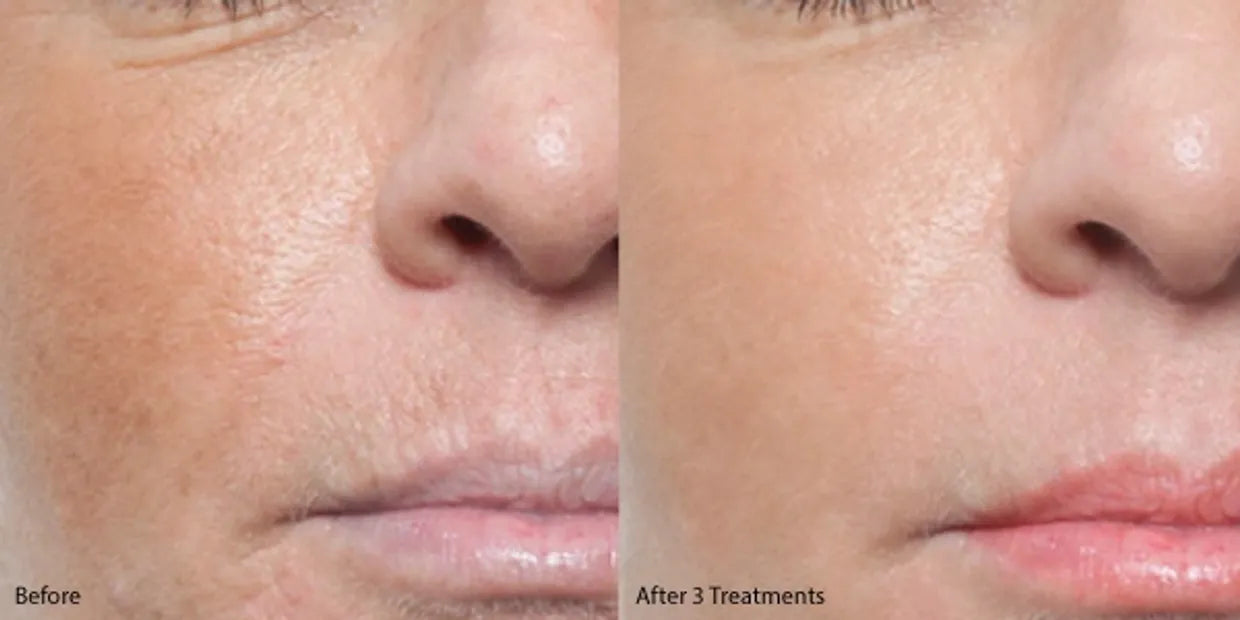 Collagen Glow Boost Bundle