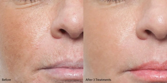 Collagen Glow Boost Bundle